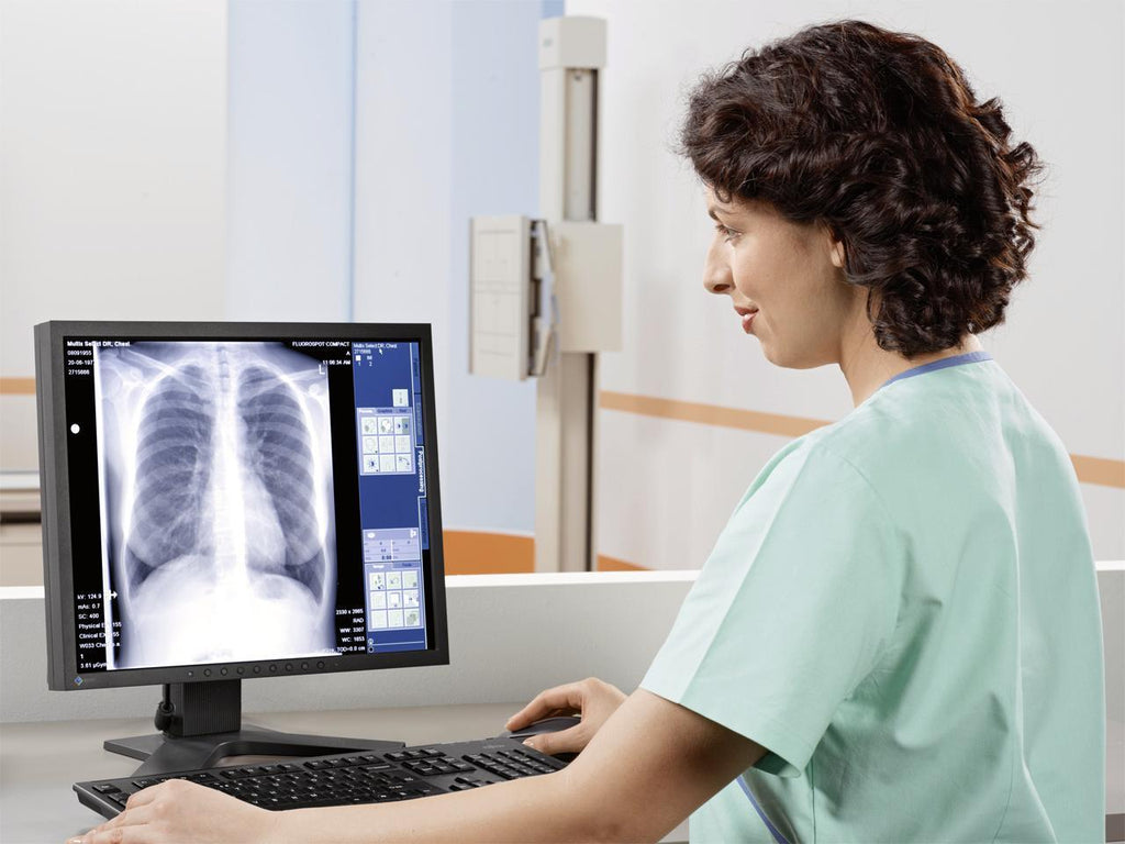 Digital Radiography X-Ray Machine | Hospital DR Imaging System
