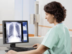 Digital Radiography X-Ray Machine | Hospital DR Imaging System
