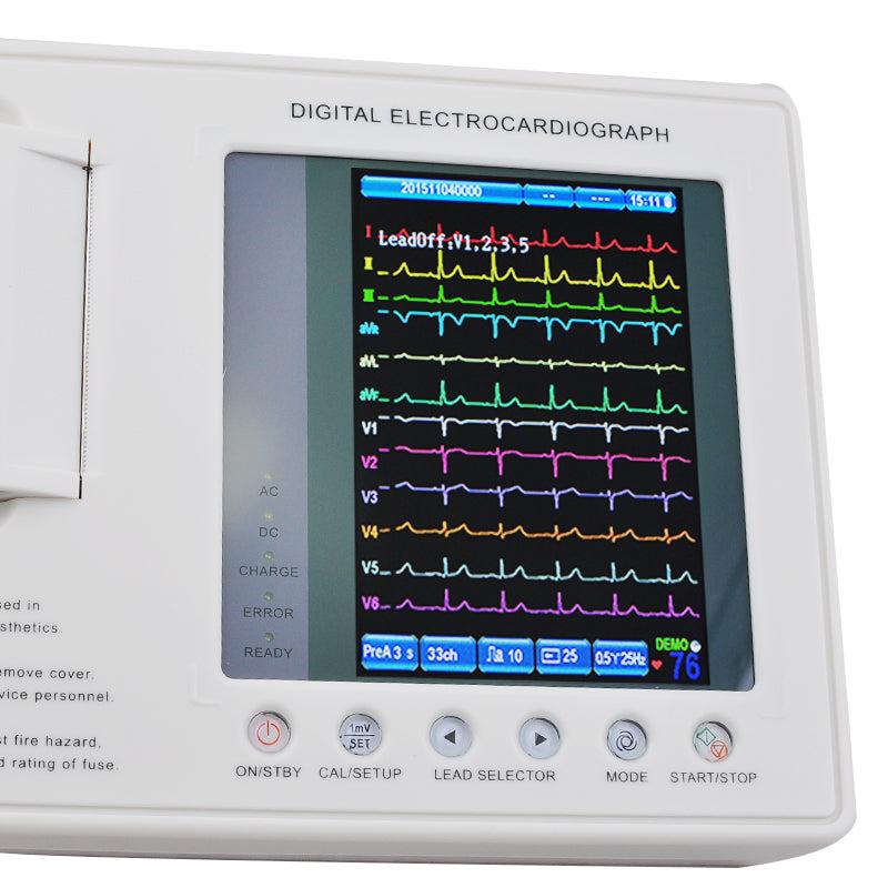 12-Lead ECG Machine | Digital Electrocardiograph for Hospitals & Clinics
