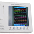 12-Lead ECG Machine | Digital Electrocardiograph for Hospitals & Clinics
