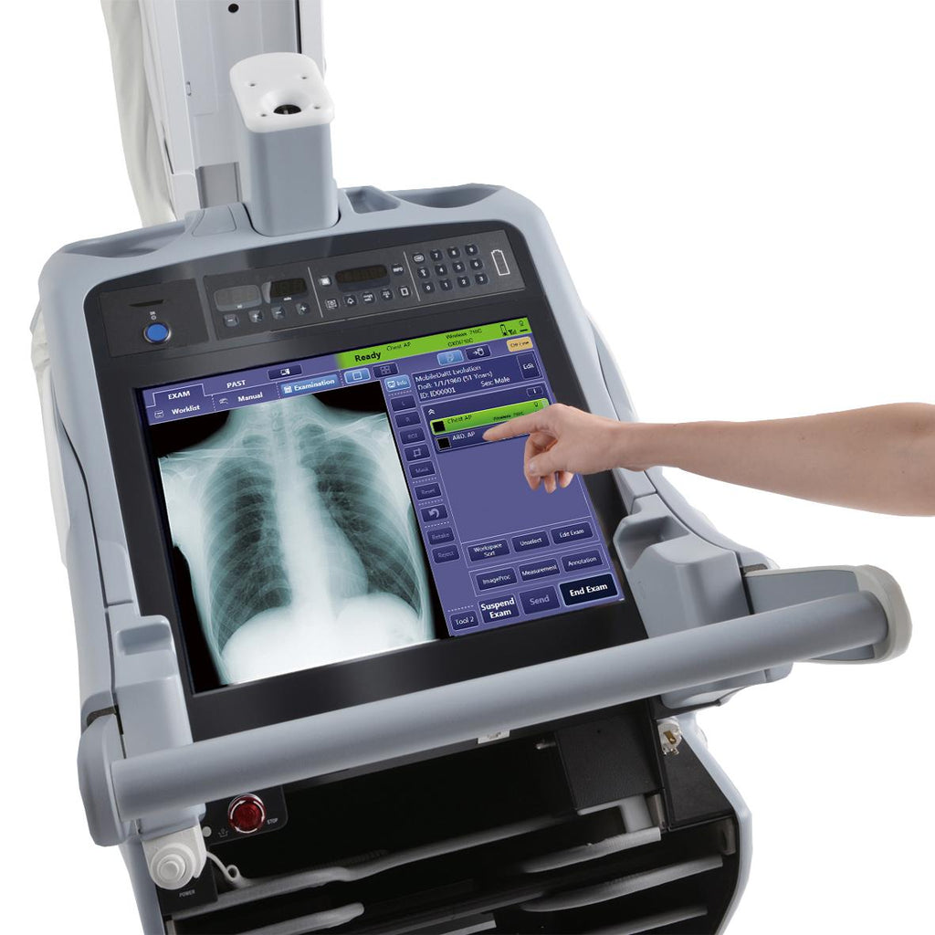 Mobile Digital X-Ray Machine | Portable Hospital DR Imaging System