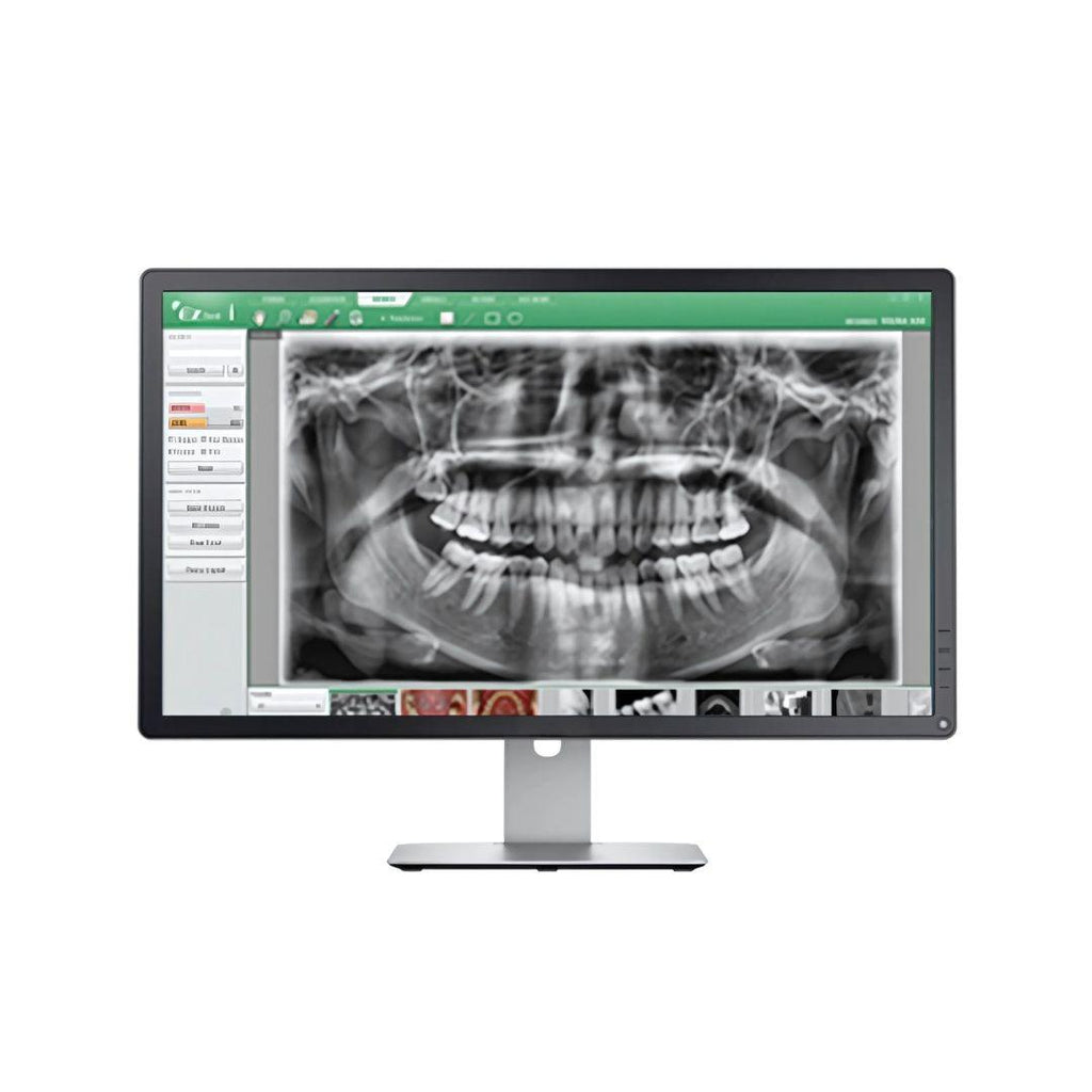 Dental Panoramic X-Ray Machine | Digital OPG Dental Imaging System