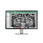 Dental Panoramic X-Ray Machine | Digital OPG Dental Imaging System