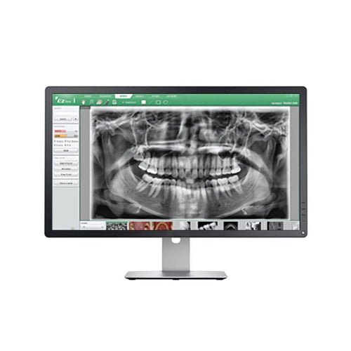 Dental Panoramic X-Ray Machine | Digital OPG Dental Imaging System