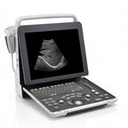 Portable Ultrasound Machine | Digital Diagnostic Ultrasound System