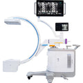 C-Arm X-Ray Machine | Mobile Surgical Fluoroscopy Imaging System