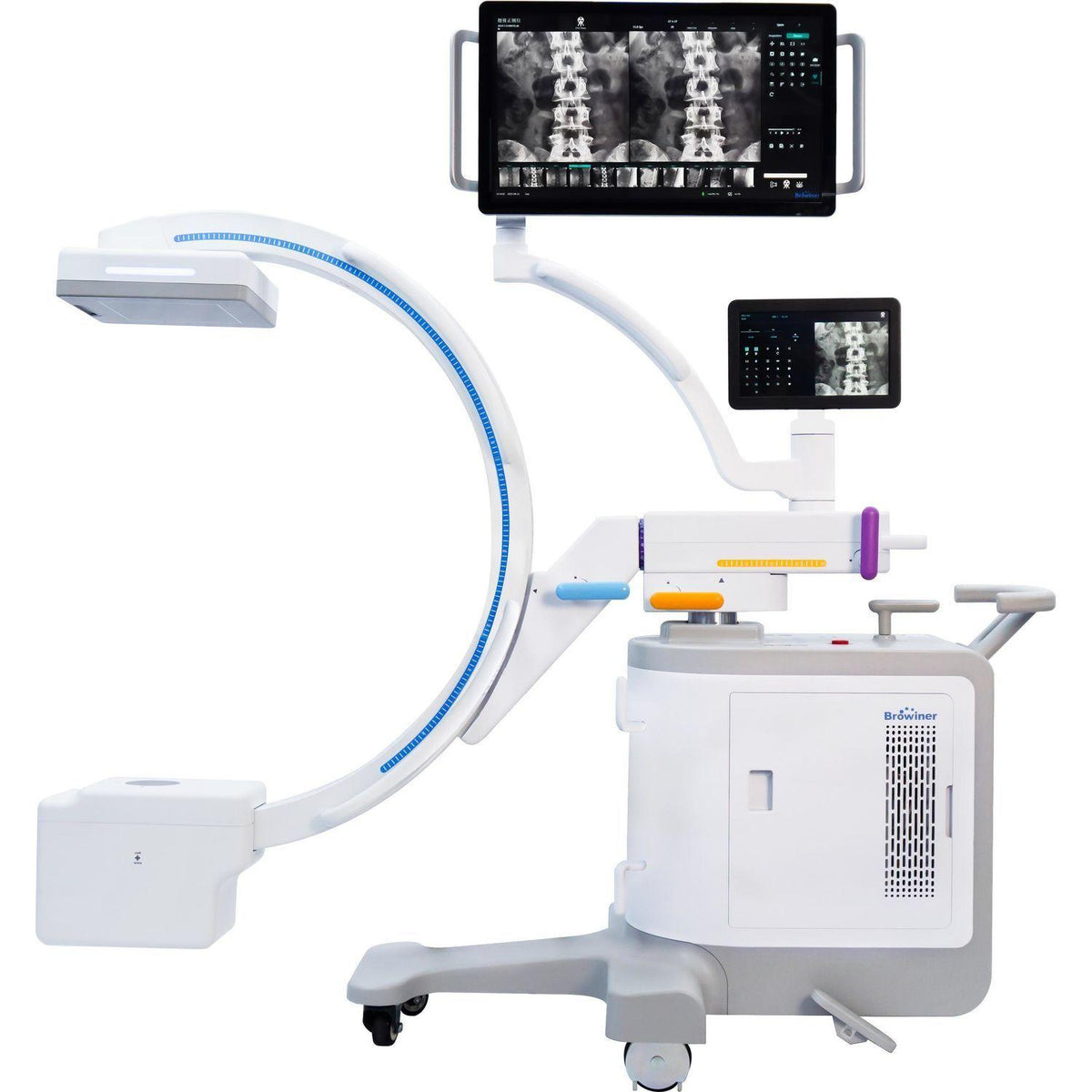 C-Arm X-Ray Machine | Mobile Surgical Fluoroscopy Imaging System