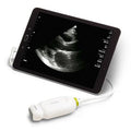Handheld Ultrasound Scanner | Portable Point-of-Care Ultrasound Device