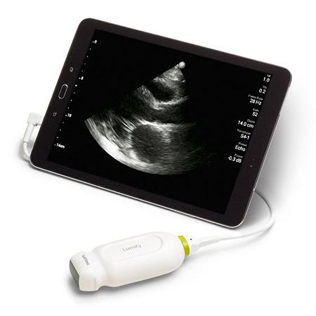 Handheld Ultrasound Scanner | Portable Point-of-Care Ultrasound Device